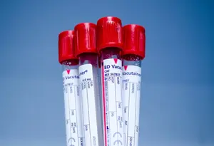 Θεσσαλονίκη: Δράση αιμοδοσίας και εγγραφών εθελοντών μυελού των οστών στην Τούμπα