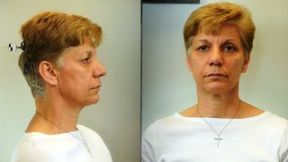 18062018gadadimosiopoihsh001s