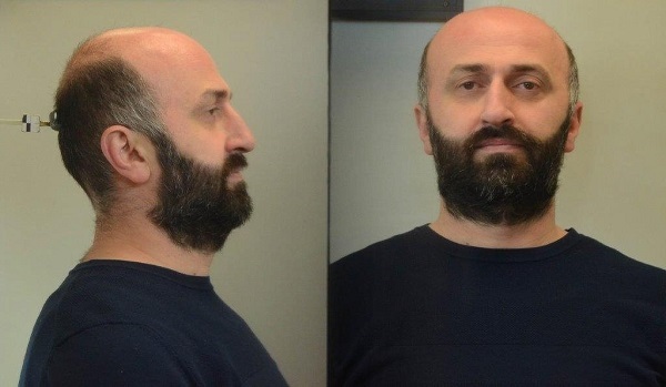 σπειρα γεωργιανοι