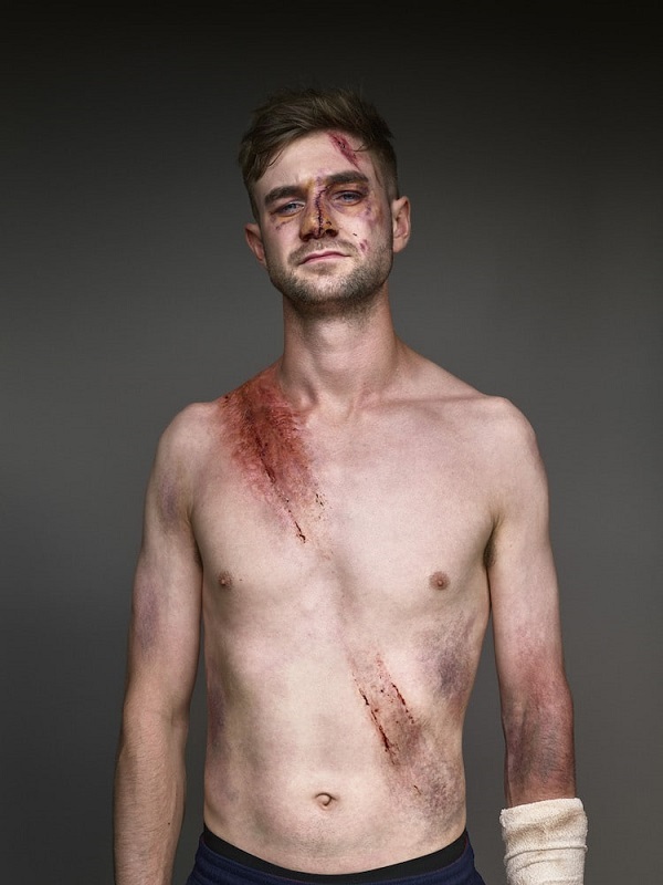 NZTA Belted Survivors 3 James M