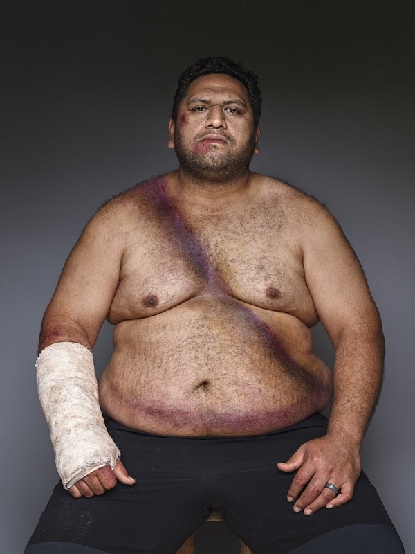 NZTA Belted Survivors 8 Rick