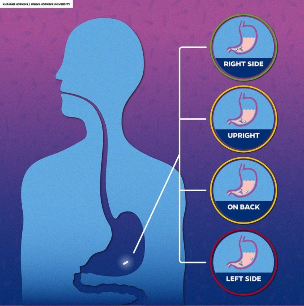 Pill Posture 777x907