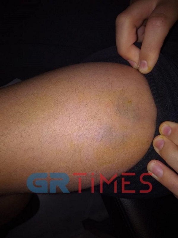 skylia thes 2811 1 768x1027