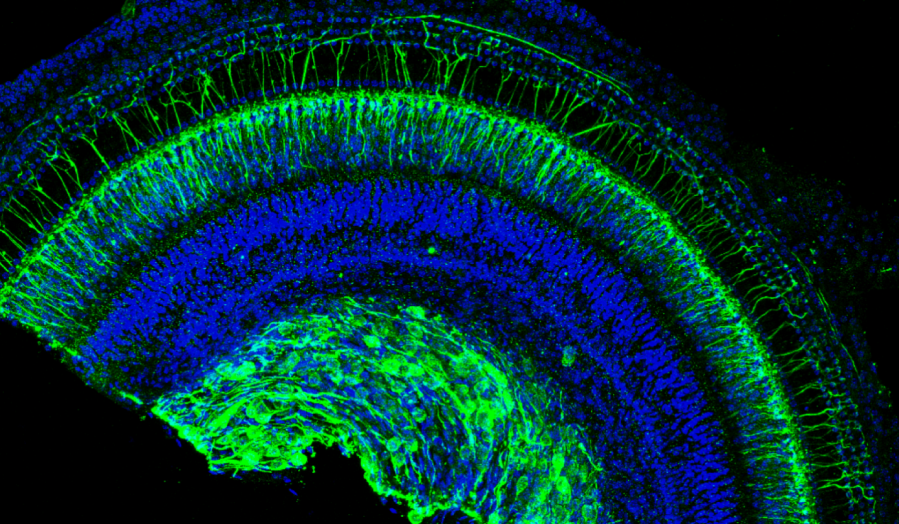 Pretty_Spiral_Cochlea-01_1_045ab.png