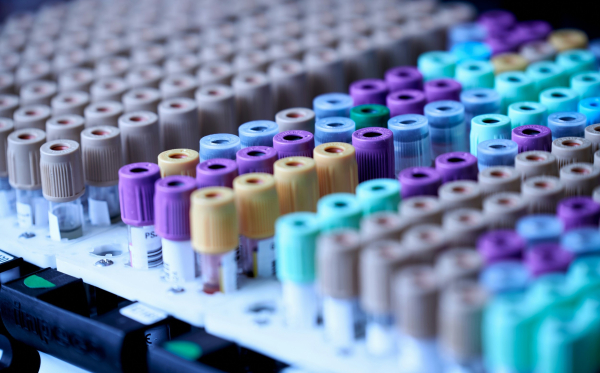 Κάθε πότε πρέπει να κάνετε εξετάσεις αίματος