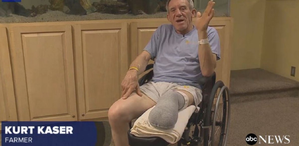 Αγρότης ακρωτηρίασε με έναν σουγιά το πόδι του - Είχε πιαστεί σε μηχάνημα