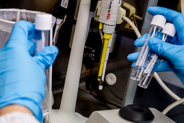 Γ. Καλαμίτσης: Κίνδυνος διεύρυνσης των καθυστερήσεων στην είσοδο νέων θεραπειών στη χώρα