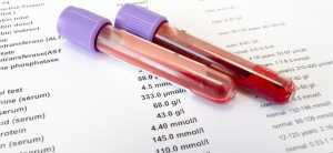 Αιματολογικές εξετάσεις στα Κέντρα Υγείας Κρήτης για όλους