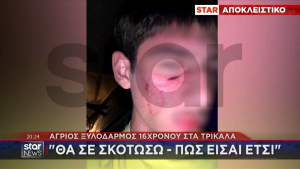 Τρίκαλα: Άγριος ξυλοδαρμός 16χρονου σε πανηγύρι - Ανήλικος του επιτέθηκε επειδή δεν του άρεσαν τα ρούχα του (Βίντεο)