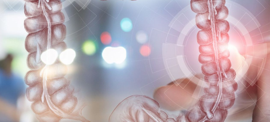 Εκκολπωμάτωση παχέος εντέρου: Παράγοντες κινδύνου και θεραπευτικές επιλογές