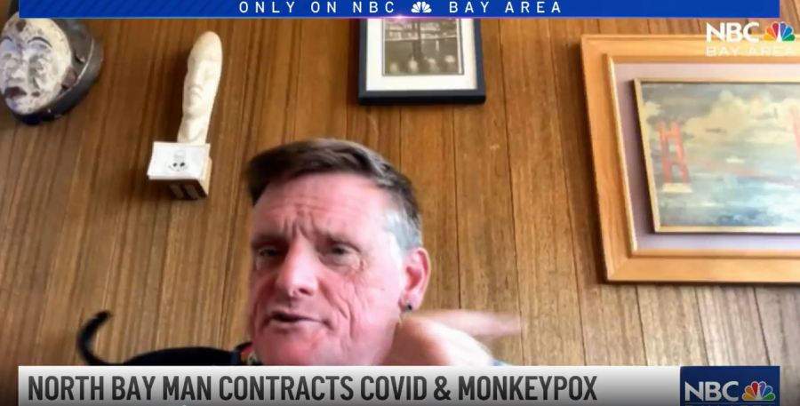 Κακή τύχη είχε άνδρας στην Καλιφόρνια: Κόλλησε ταυτόχρονα κορονοϊό και ευλογιά των πιθήκων