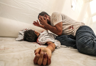 Γάζα: Συγκλονίζει ο γιατρός που του πήγαν στο νοσοκομείο νεκρά τα δύο παιδιά του και τη μάνα του!