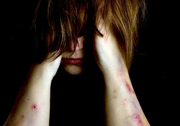 Ανησυχητικά στοιχεία για την κακοποίηση των γυναικών - Δωρεάν επισκέψεις στα ιατροδικαστικά ιατρεία