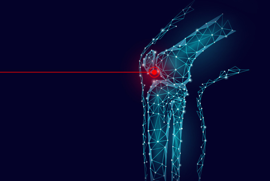 Πόνος στο γόνατο; Πότε χρειάζεται αρθροπλαστική;