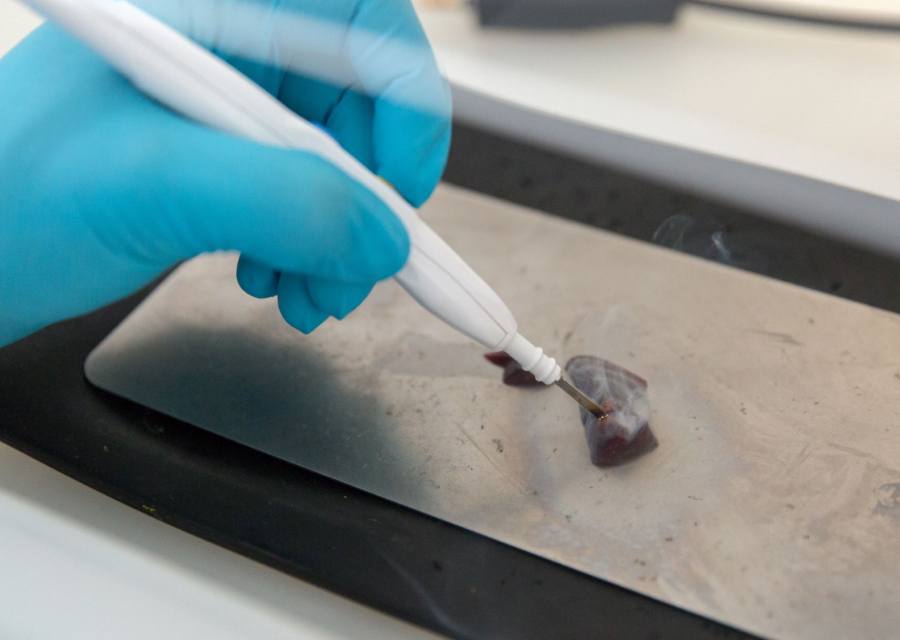 Νυστέρι που «μυρίζει όγκους» ανιχνεύει τον καρκίνο της μήτρας μέσα σε λίγα δευτερόλεπτα