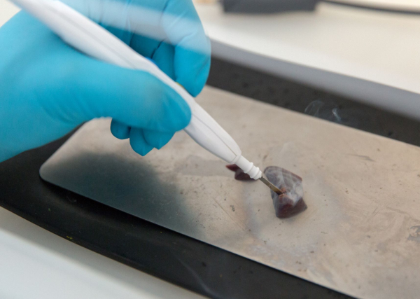 Νυστέρι που «μυρίζει όγκους» ανιχνεύει τον καρκίνο της μήτρας μέσα σε λίγα δευτερόλεπτα