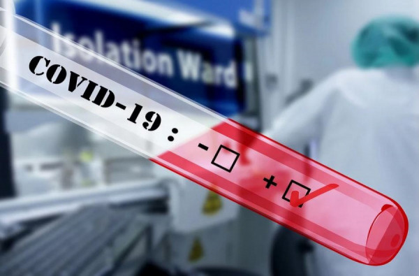 Κορονοϊός: Εγκρίθηκε το πρώτο τεστ που εντοπίζει τον ιό σε 20 λεπτά!