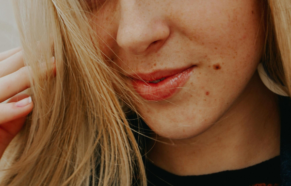 Αυξημένη χοληστερίνη: Ποια είναι τα δύο προειδοποιητικά σημάδια στο πρόσωπο