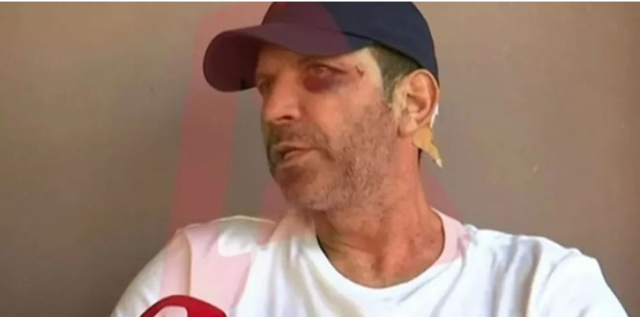 Αγρίνιο: Τον ξυλοκόπησαν επειδή δεν τους άρεσε το φαγητό - «Μου άνοιξαν το κεφάλι σε δύο σημεία»