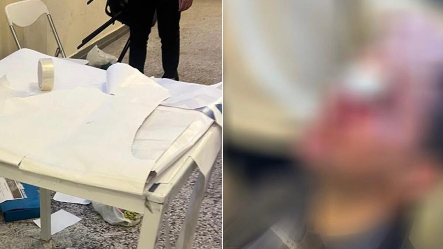 ΕΚΠΑ για επεισόδια στη Νομική: «Ευθύνη της Πολιτείας η προστασία από ομάδες κουκουλοφόρων»