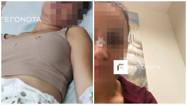 Βόλος: Διεθνής αθλητής χτύπησε την πρώην σύζυγό του μπροστά στο παιδί τους -Σοκάρουν οι φωτογραφίες