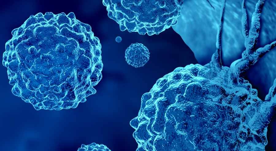 Μεταστατικός καρκίνος: Όταν δεν εντοπίζεται η αρχική εστία