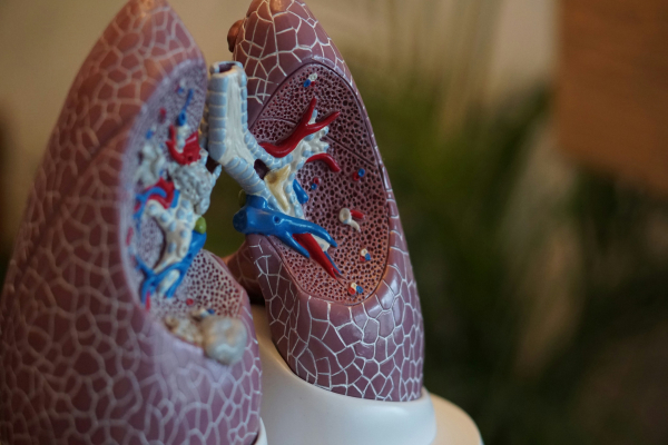 Καρκίνος του πνεύμονα: Ο FDA ενέκρινε φάρμακο της Amgen - Ποιους ασθενείς αφορά