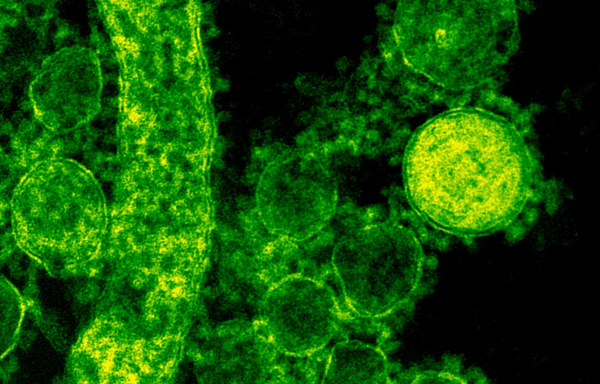 Τι είναι το επικίνδυνο βακτήριο λεγιονέλλα που εντοπίστηκε στο νερό φοιτητικής εστίας του ΕΚΠΑ