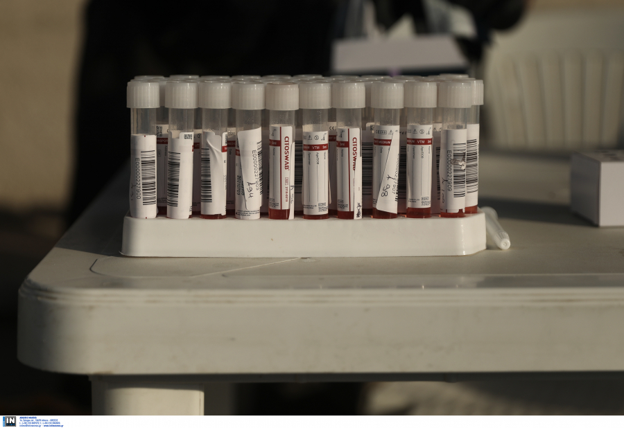 ΠΟΥ: Παγκόσμια συμφωνία για δωρεάν χορήγηση τεστ αντισωμάτων κορoνοϊού σε φτωχές χώρες