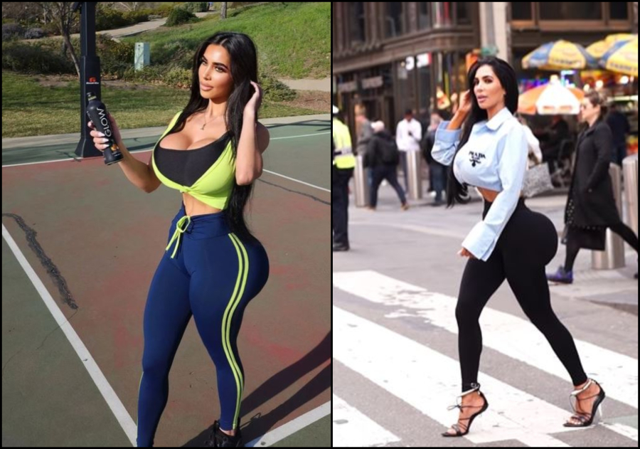 Σοκ με τον θάνατο της σωσία της Κιμ Καρντάσιαν: Έπαθε ανακοπή μετά από πλαστική επέμβαση