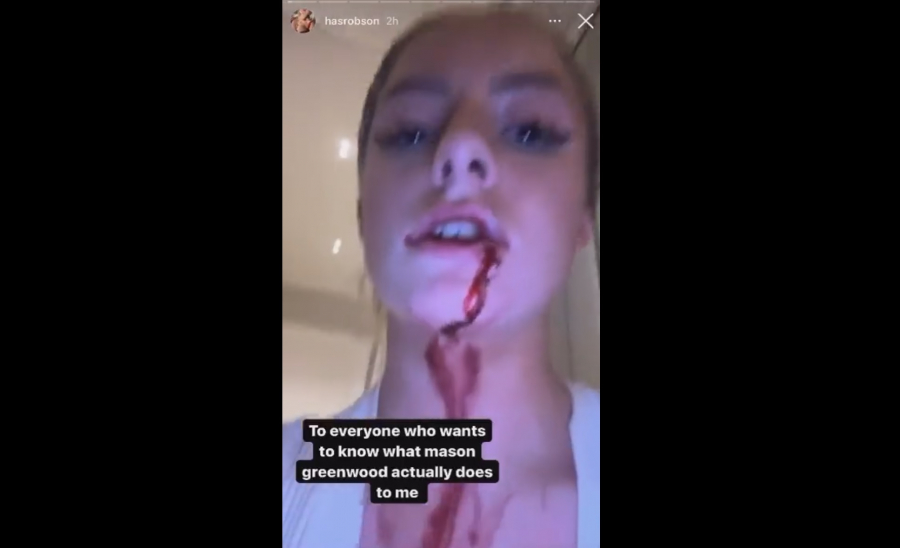 Συνελήφθη με την κατηγορία βιασμού και ξυλοδαρμού επιθετικός της Μάντσεστερ Γιουνάιτεντ (εικόνες)