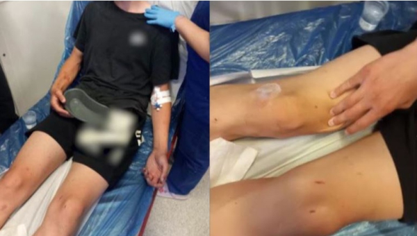 Καλαμάτα: «Πήγε να ζητήσει συγγνώμη και τον έσερναν στο δρόμο» – Συγκλονίζει η μητέρα του ενός ανήλικου