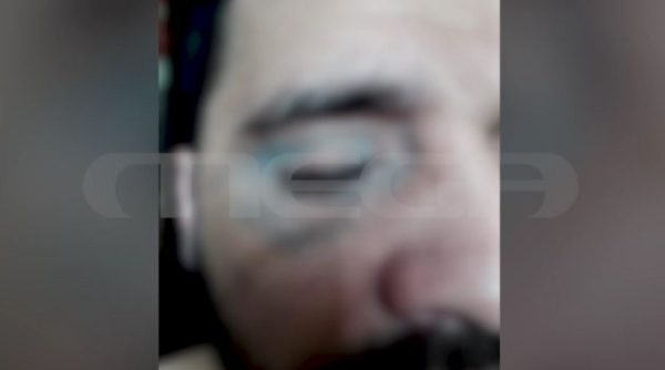 Άγριος βασανισμός 33χρονου κρατούμενου από αστυνομικούς, «μάνα σώσε με γιατί με σκοτώνουν»