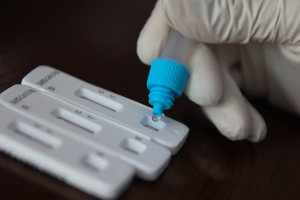 ΕΟΔΥ: Τα σημεία για rapid test σήμερα 5 Σεπτεμβρίου