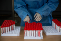 Μετάλλαξη Όμικρον: Πέντε κρούσματα στην Ελλάδα, ποιο είναι το προφίλ τους