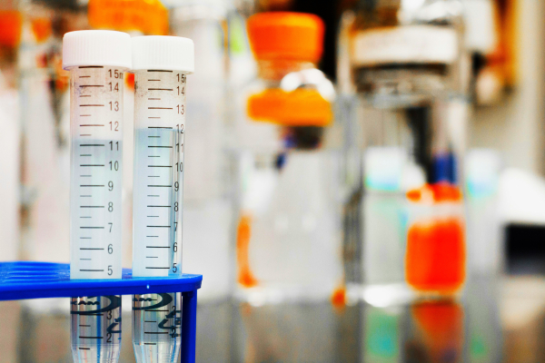 Μια απλή εξέταση αίματος θα μπορούσε να προβλέψει τον κίνδυνο άνοιας