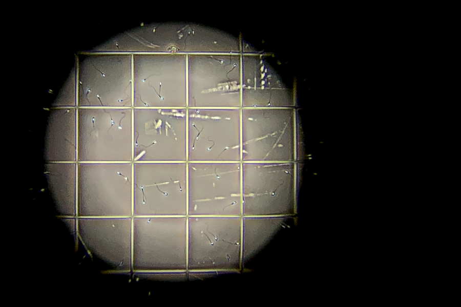 Έρευνα BBC: Σπέρμα δότη συνδέεται με καρκίνο σε παιδιά - Στάλθηκε και στην Ελλάδα