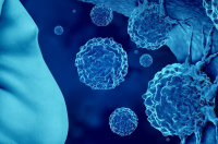 Παχυσαρκία: Πώς συνδέεται με τον καρκίνο;