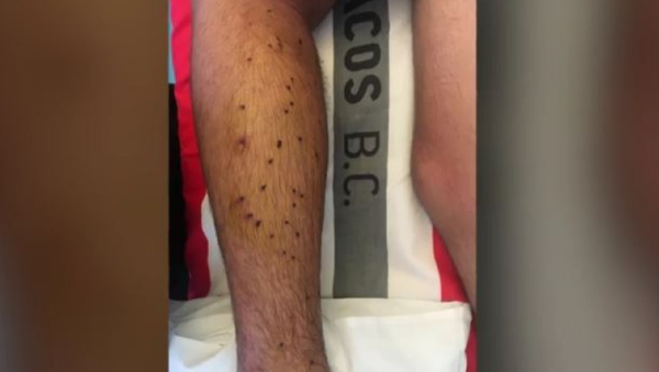 Αλεποχώρι: Φωτογραφίες ντοκουμέντο από τα τραύματα του 14χρονου, «δεν μπήκαν για να κλέψουν» λέει η μητέρα του (βίντεο)