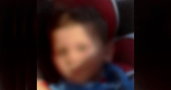 Ηράκλειο: Αρνητικά τα πρώτα τεστ για την λειτουργία του εγκεφάλου του 3χρονου