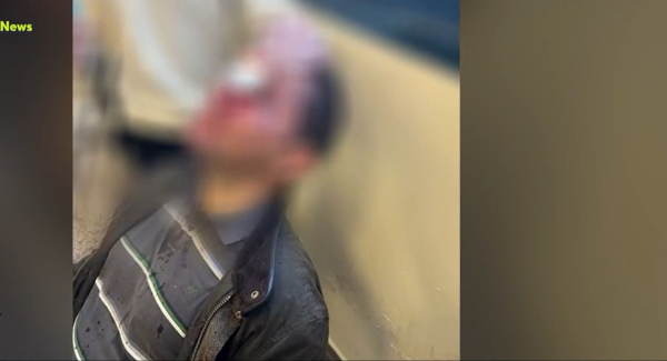 Νέες αποκαλύψεις Γρίβα για την επίθεση στη Νομική Αθηνών: Έγκυος κοπέλα υπέστη σοκ