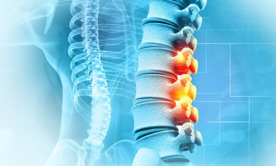 Νέα εποχή στη χειρουργική σπονδυλικής στήλης