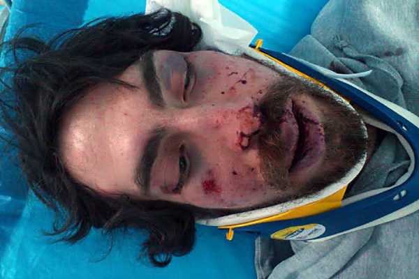 Το χρονικό του άγριου ξυλοδαρμού του 24χρονου φοιτητή από Χρυσαυγίτες