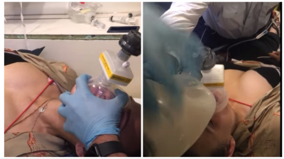 Η προσπάθεια γιατρού να διασωληνώσει μέσα στο ασθενοφόρο 39χρονη που τη δάγκωσε οχιά -Σοκαριστικό βίντεο