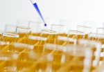 Πολλοί «υγιείς» άνθρωποι μπορεί να έχουν στο DNA τους γενετικές μεταλλάξεις για κάποια σπάνια νόσο