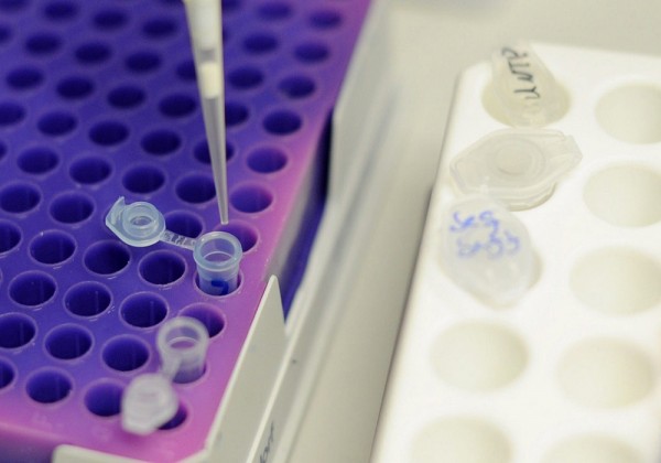 Ανακαλύφθηκαν 72 νέες γενετικές μεταλλάξεις που αυξάνουν τον κίνδυνο για καρκίνο του μαστού