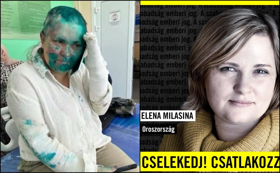Σοκαριστική επίθεση σε Ρωσίδα δημοσιογράφο: Της έσπασαν τα δάχτυλα, την κούρεψαν γουλί και της έριξαν μπογιά