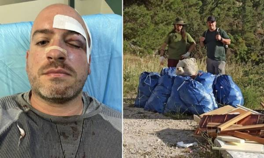 Κικίλιας: Καμία ανοχή στους δράστες της απρόκλητης επίθεσης στους εθελοντές της Πάρνηθας