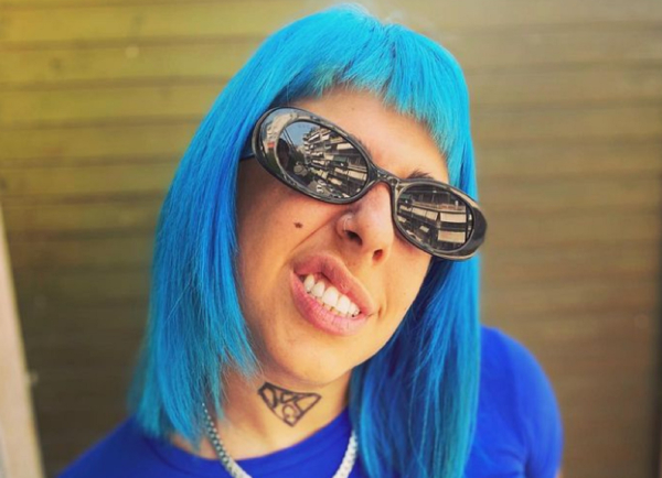 Η Super Κική μίλησε: Ανέβασε φωτογραφίες σοκ από την κακοποίηση της φίλης της, «θα το έκανα όσες φορές ακόμη χρειαστεί»