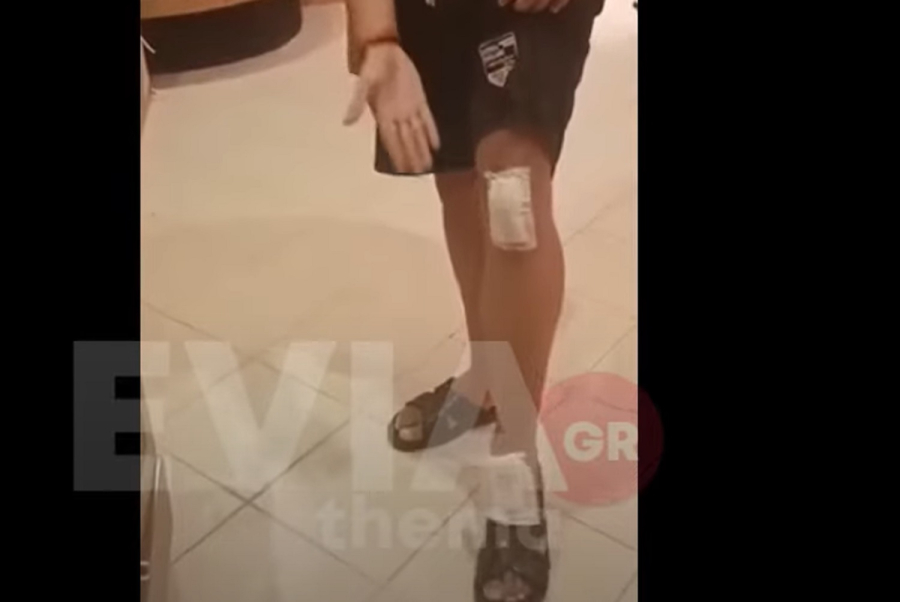 Εύβοια: Χτύπησαν άγρια μητέρα και γιο επειδή είπαν στους γείτονες τους να μην χτυπάνε τα σκυλιά (βίντεο)